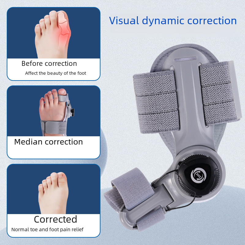 Upgraded adjustable bunion corrector by My Store, showing a close-up of the orthotic device designed for toe alignment.